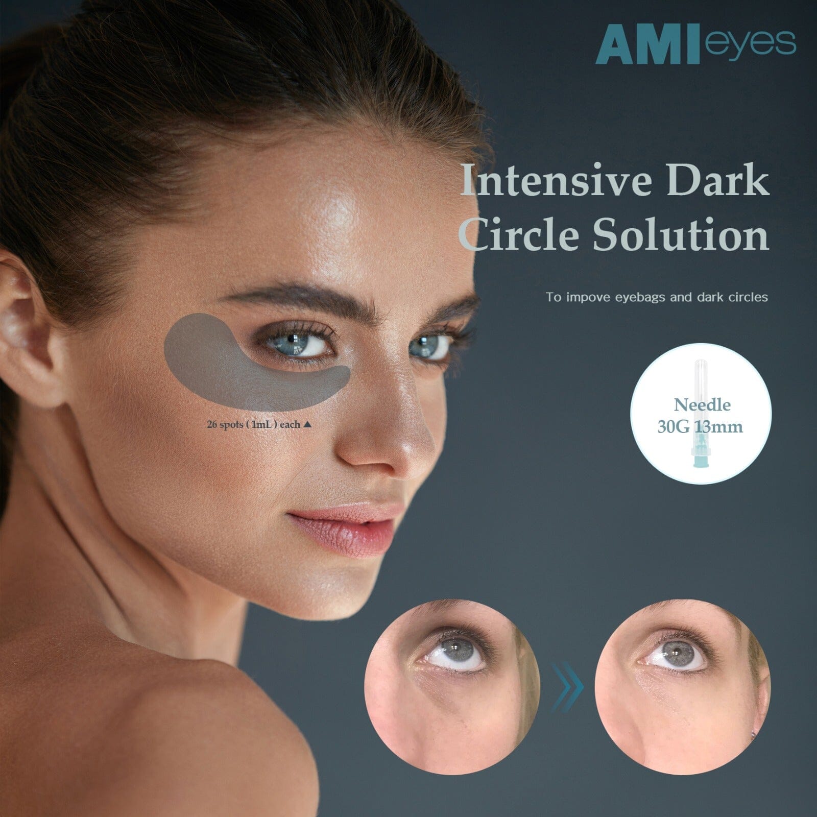 AMI EYES - Image 6