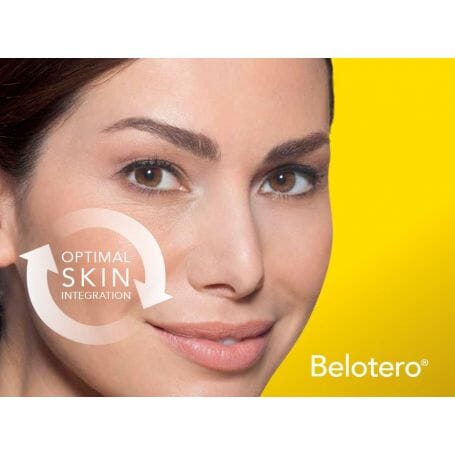 Belotero soft with Lidocaine - Image 4