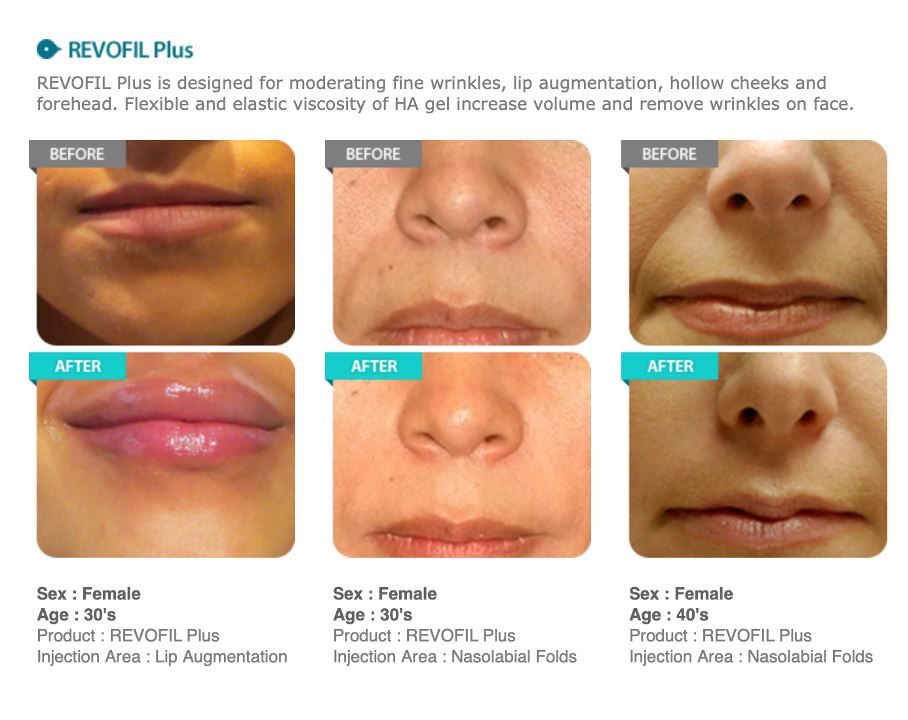 REVOFIL PLUS - Image 2
