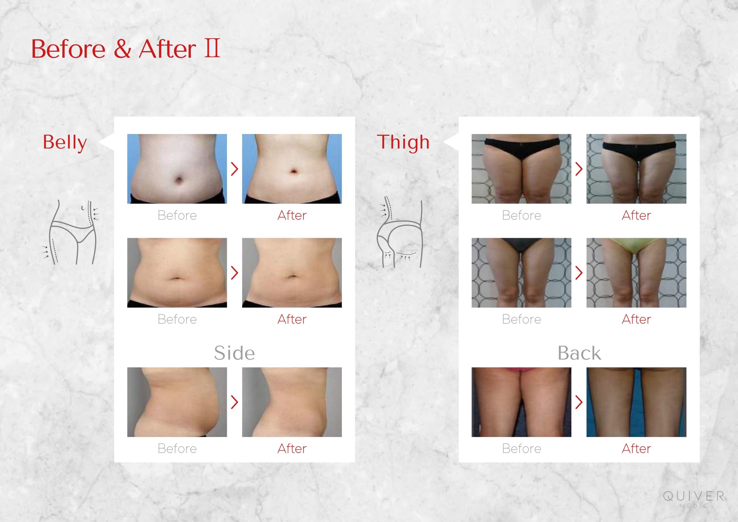 SLIM POINT BODY - Image 12
