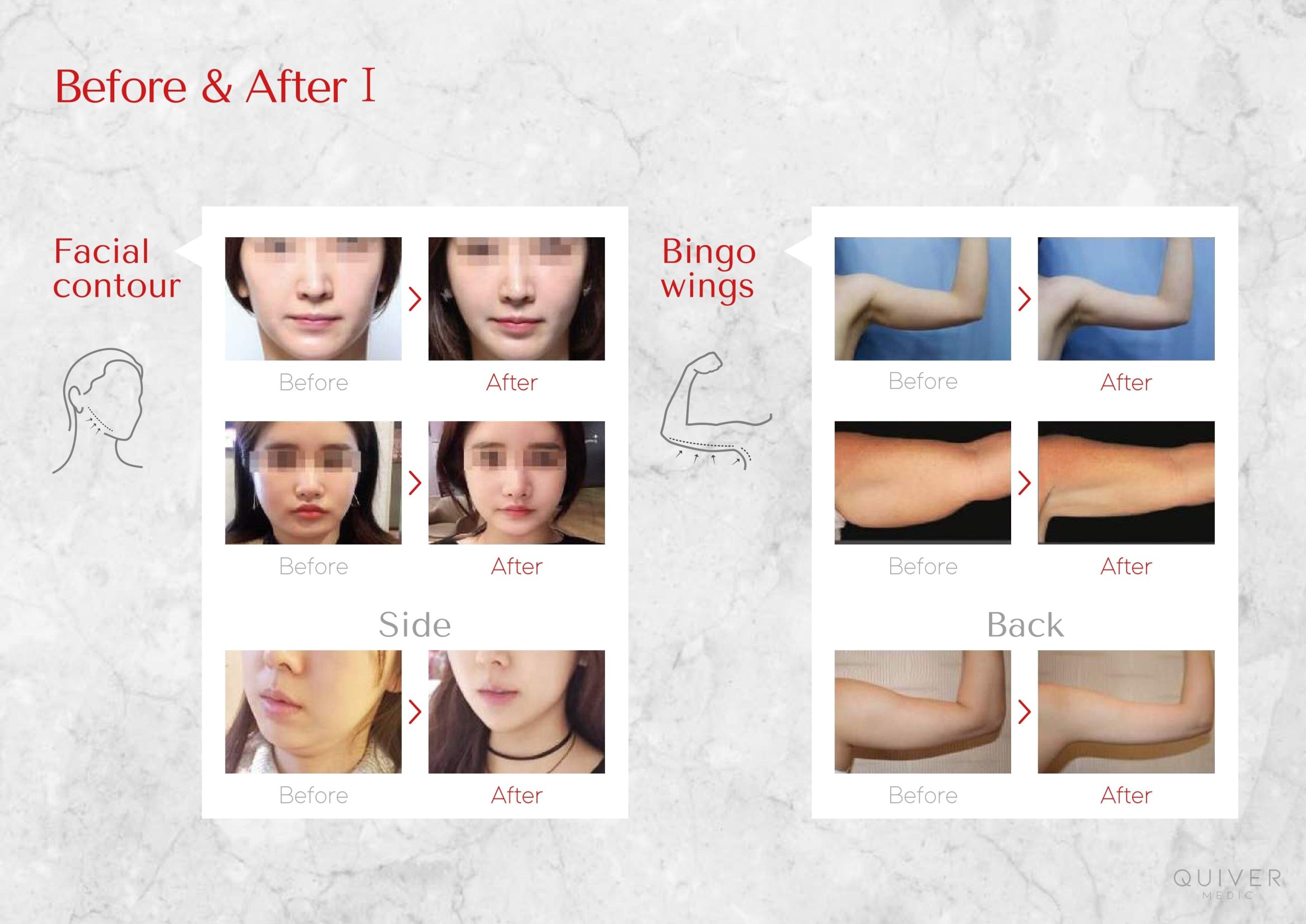 SLIM POINT BODY - Image 11